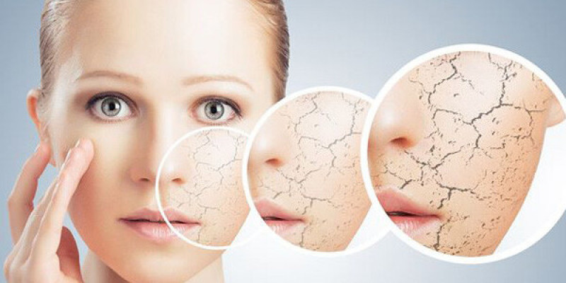 Як доглядати за сухою шкірою обличчя