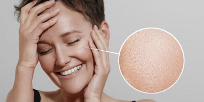 Догляд за жирною шкірою: краще сяяти, ніж відблискувати